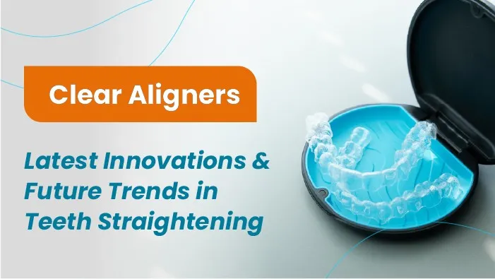 Clear Aligners